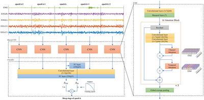 A two-branch trade-off neural network for balanced scoring sleep stages on multiple cohorts